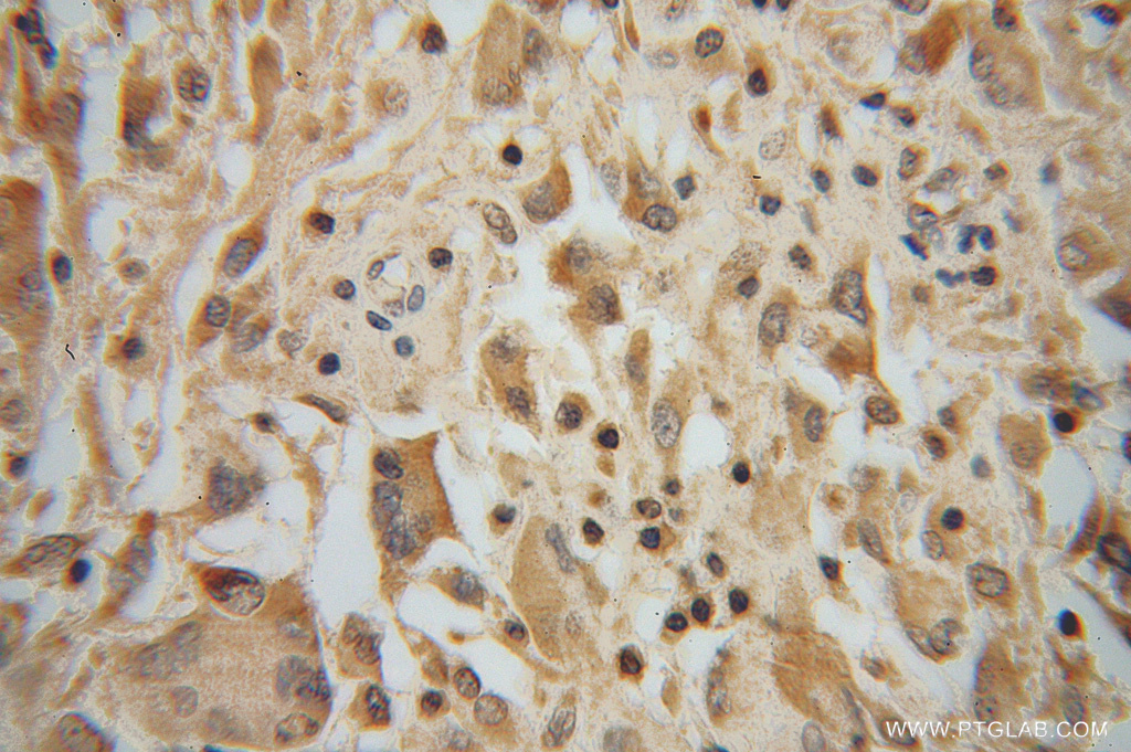 PPM1K Polyclonal antibody