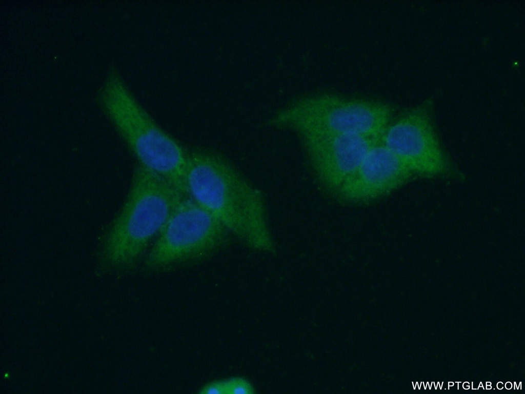 CES3 Polyclonal antibody