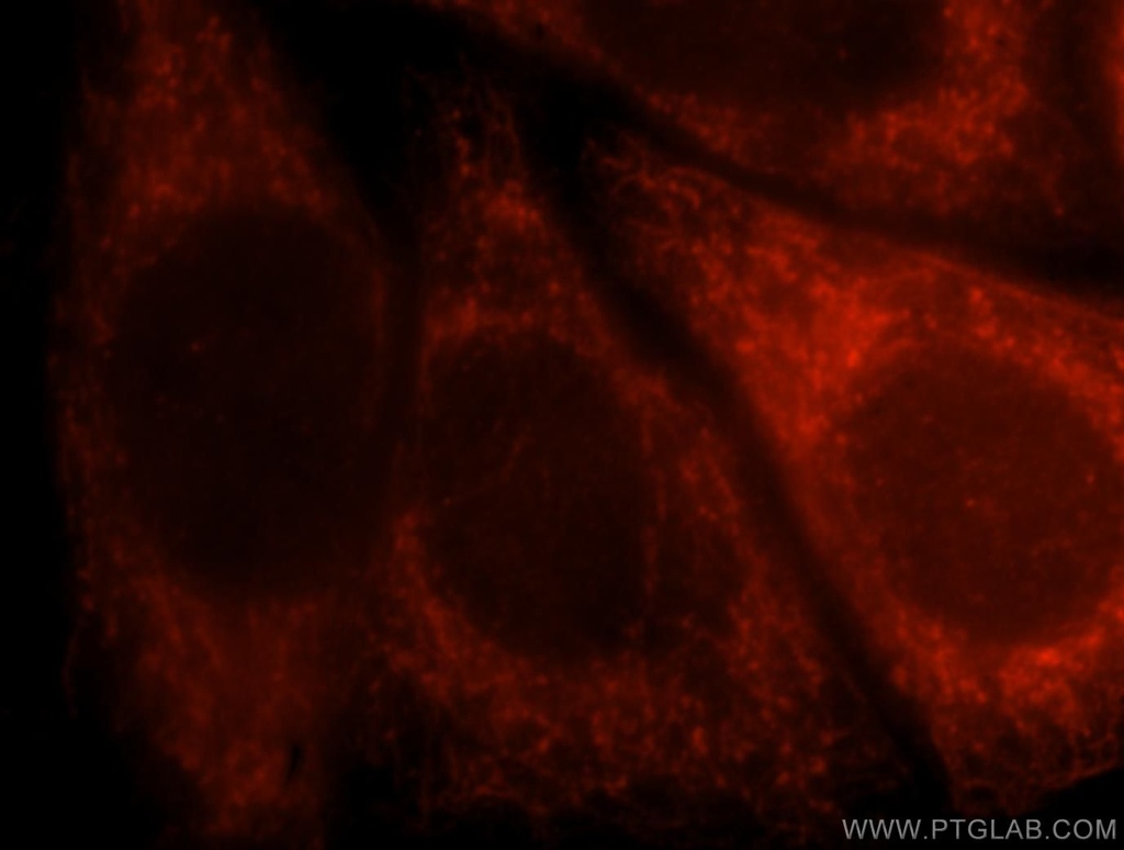 AFG3L2 Polyclonal antibody