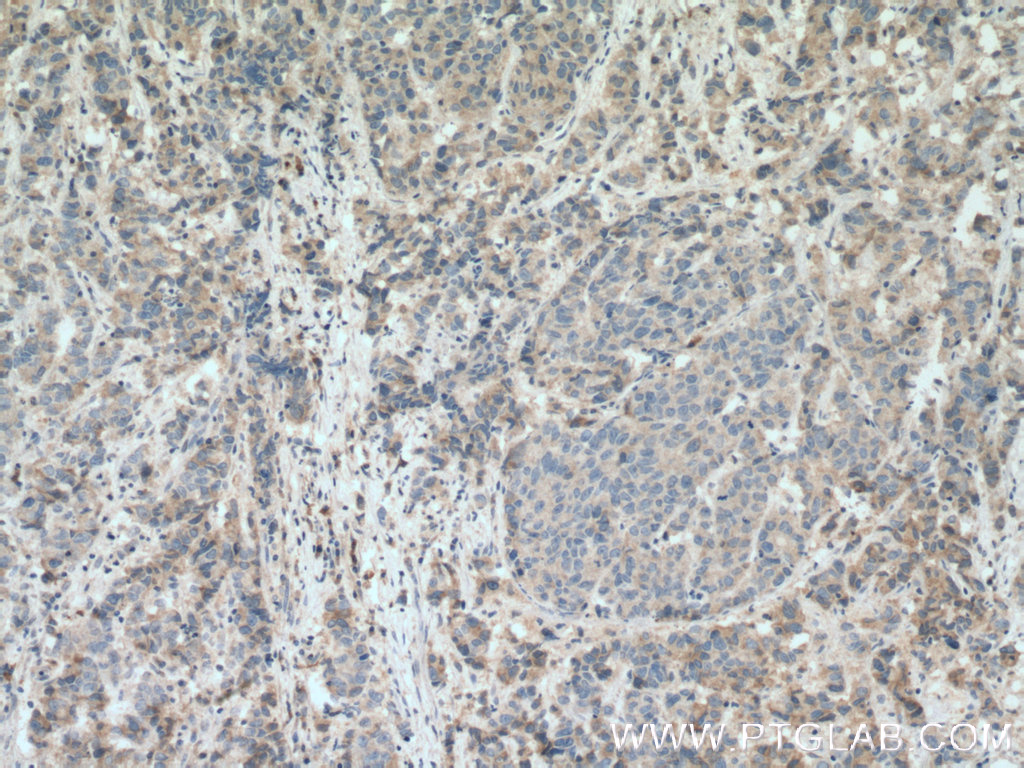 PHLDA2 Polyclonal antibody
