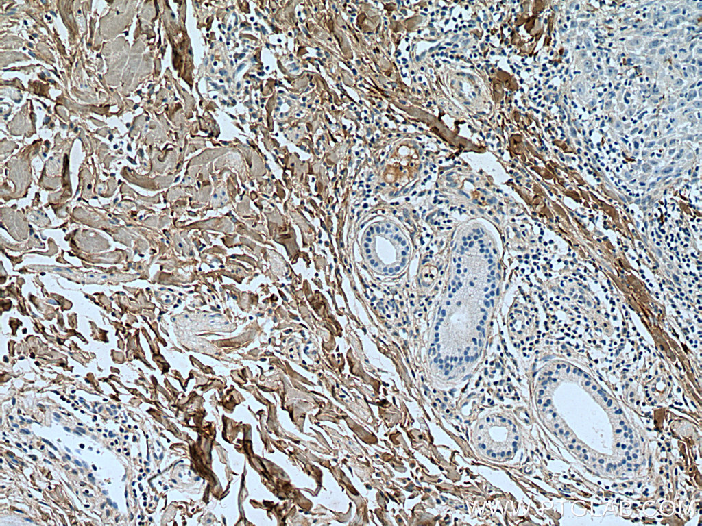 Collagen Type I Polyclonal antibody