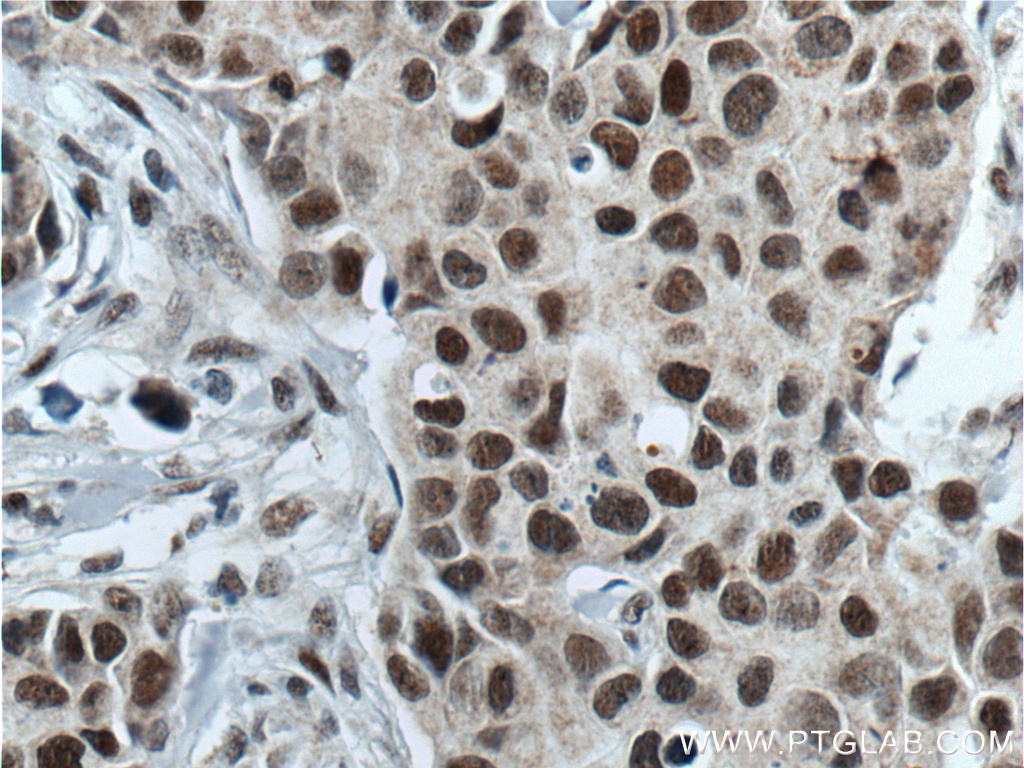 ATF7IP Polyclonal antibody
