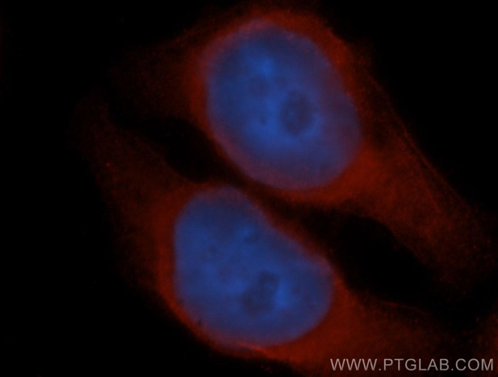 UBXD1 Polyclonal antibody