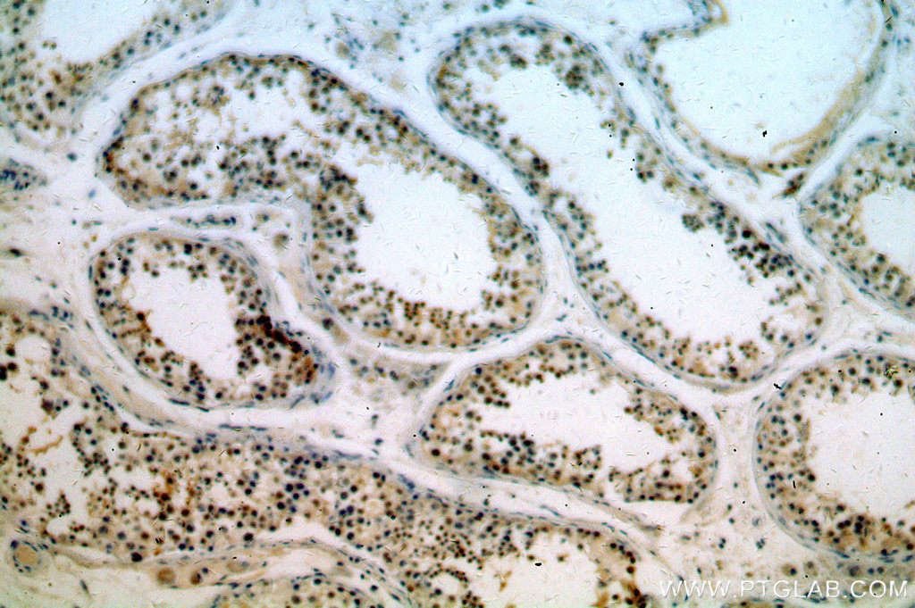 KLF6 Polyclonal antibody