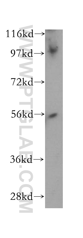 PWP1 Polyclonal antibody