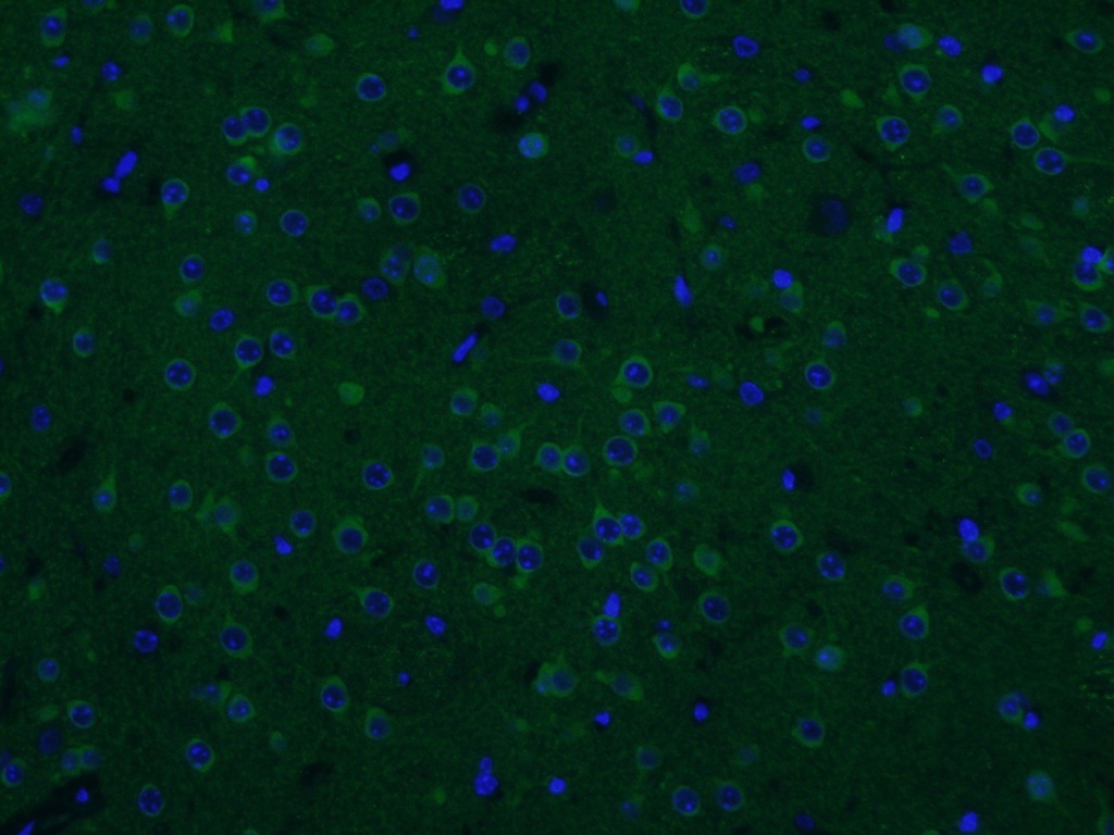 CAMKV Polyclonal antibody