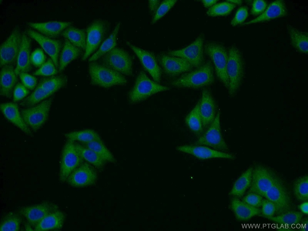 GIPC1 Polyclonal antibody