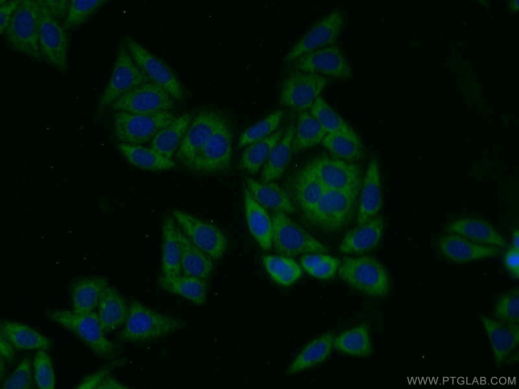 PIG3 Polyclonal antibody