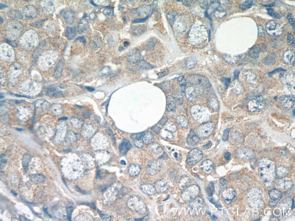 ATF2-Specific Polyclonal antibody