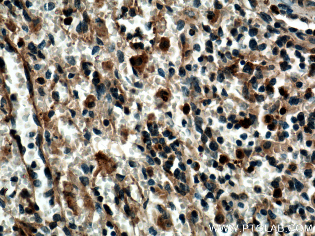 SYK Polyclonal antibody