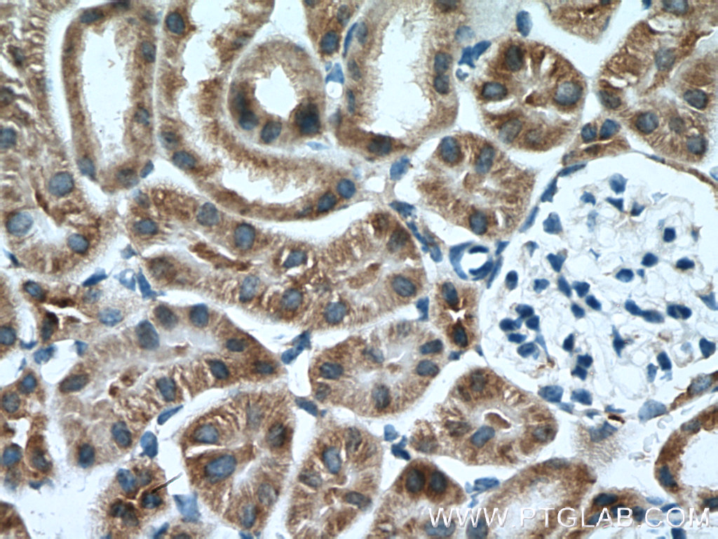 AARSD1 Polyclonal antibody