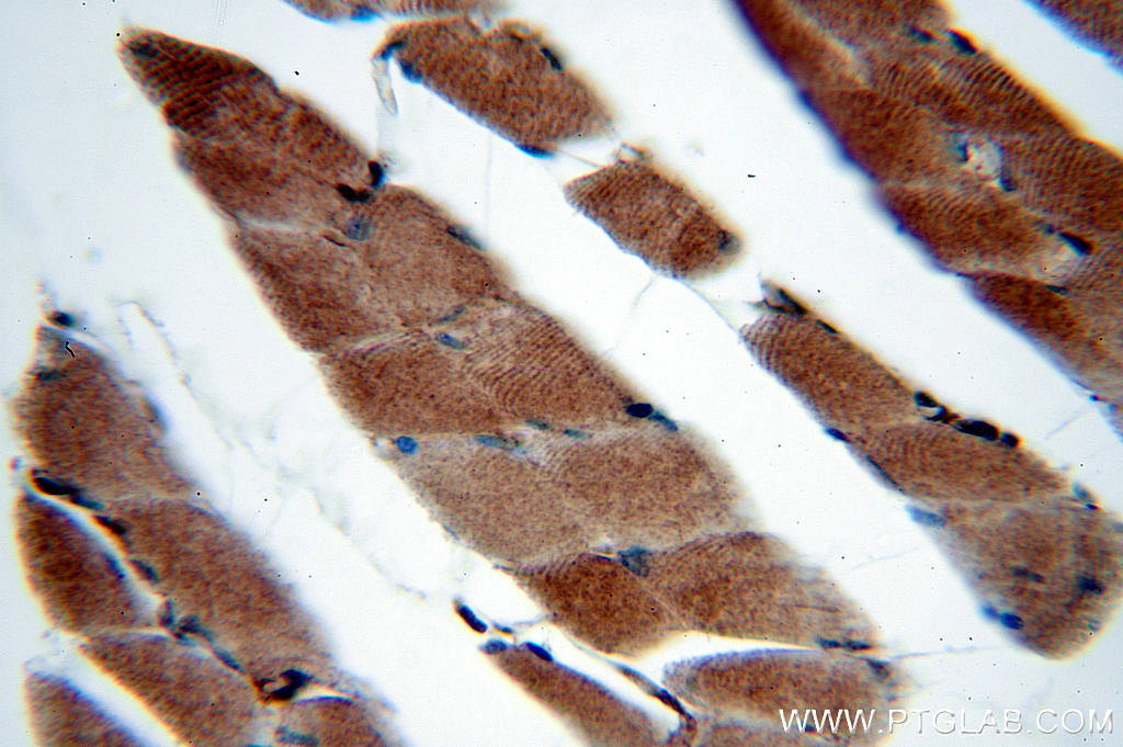 SERPINB6 Polyclonal antibody