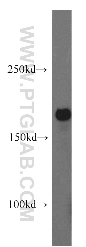 ABCB6 Polyclonal antibody