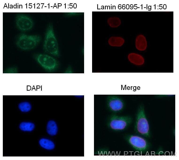 ALADIN Polyclonal antibody