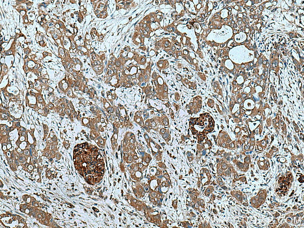 ATG4B Polyclonal antibody