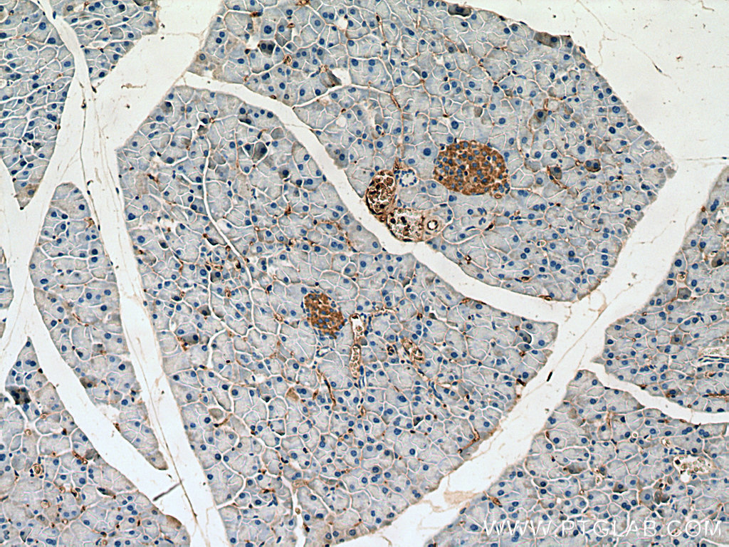 INPP5B Polyclonal antibody