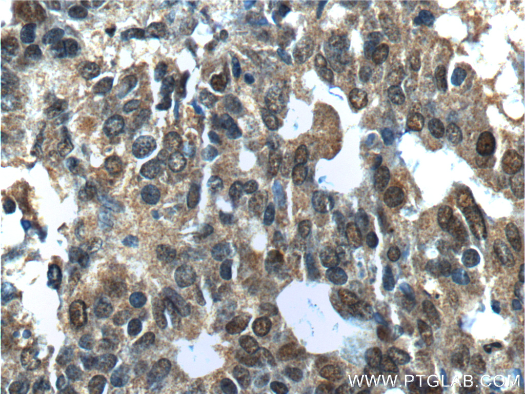 NANS Polyclonal antibody