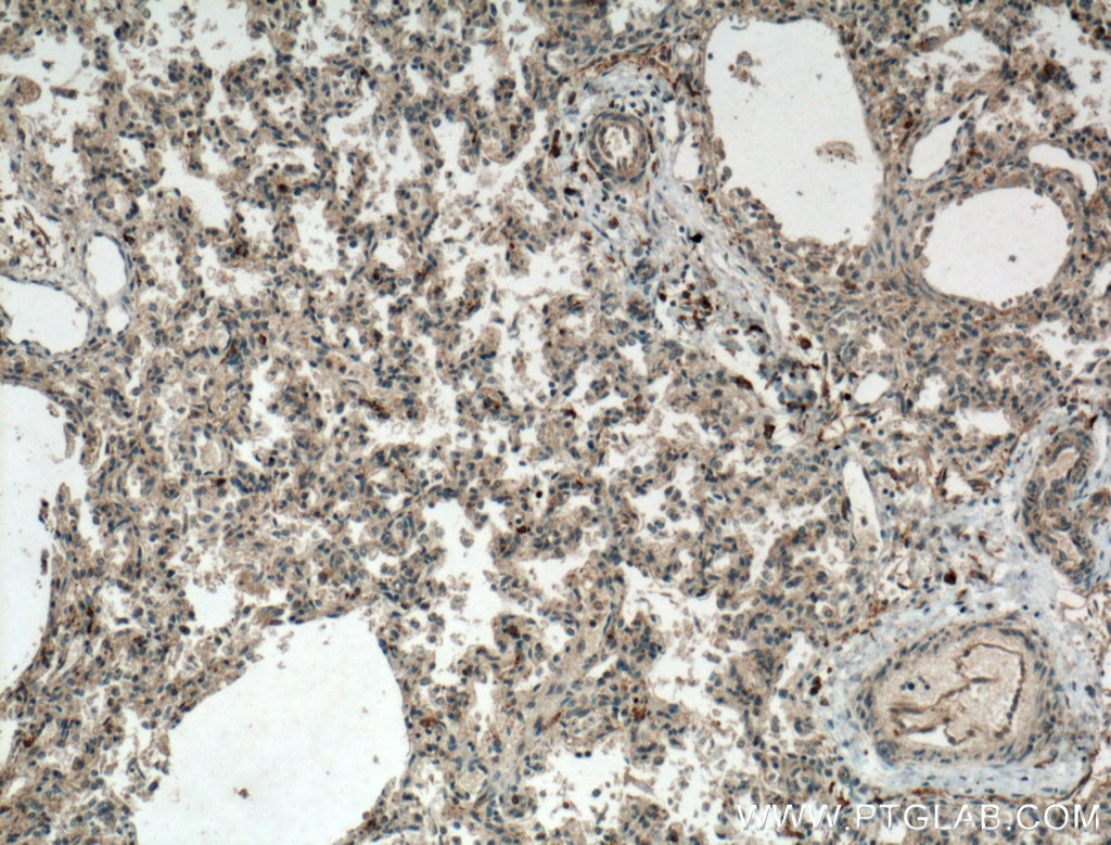 WDR18 Polyclonal antibody
