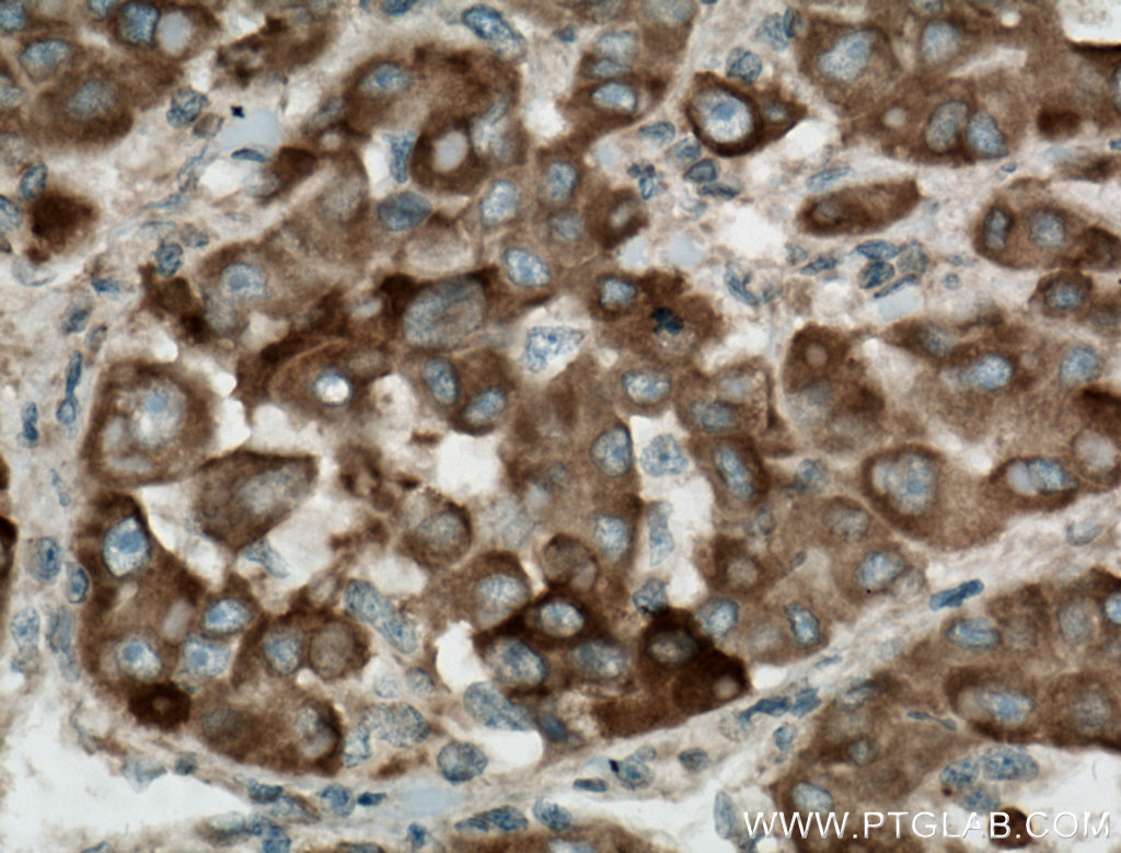 SIGMAR1 Polyclonal antibody