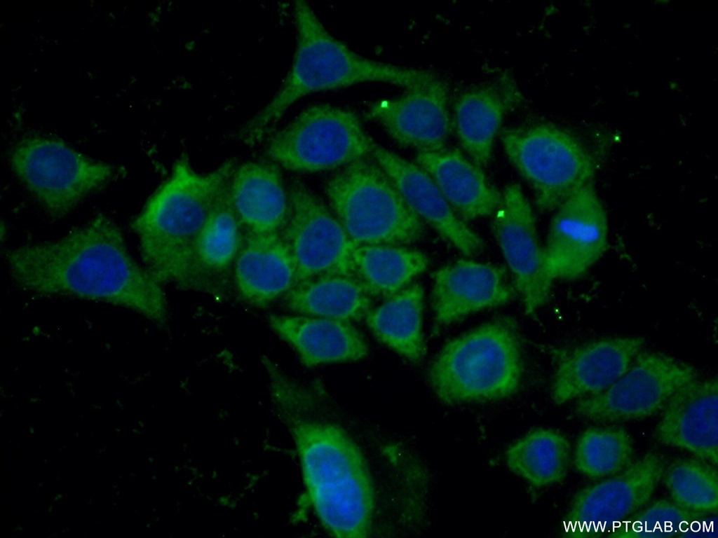 GPI Polyclonal antibody
