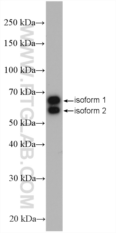 Retrolinkin Polyclonal antibody