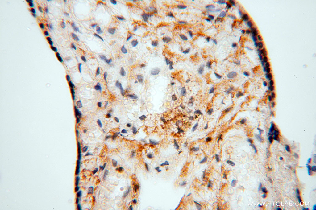 NLRP2 Polyclonal antibody