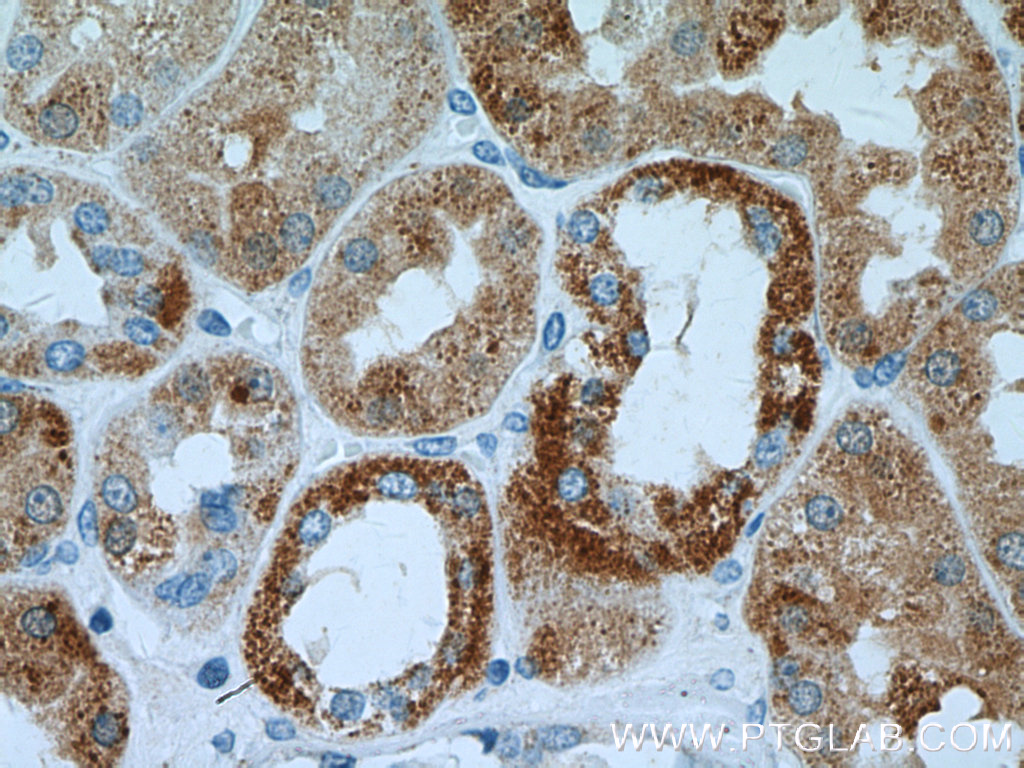 DCXR Polyclonal antibody