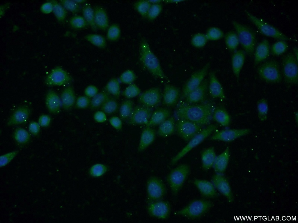 DHFR Polyclonal antibody