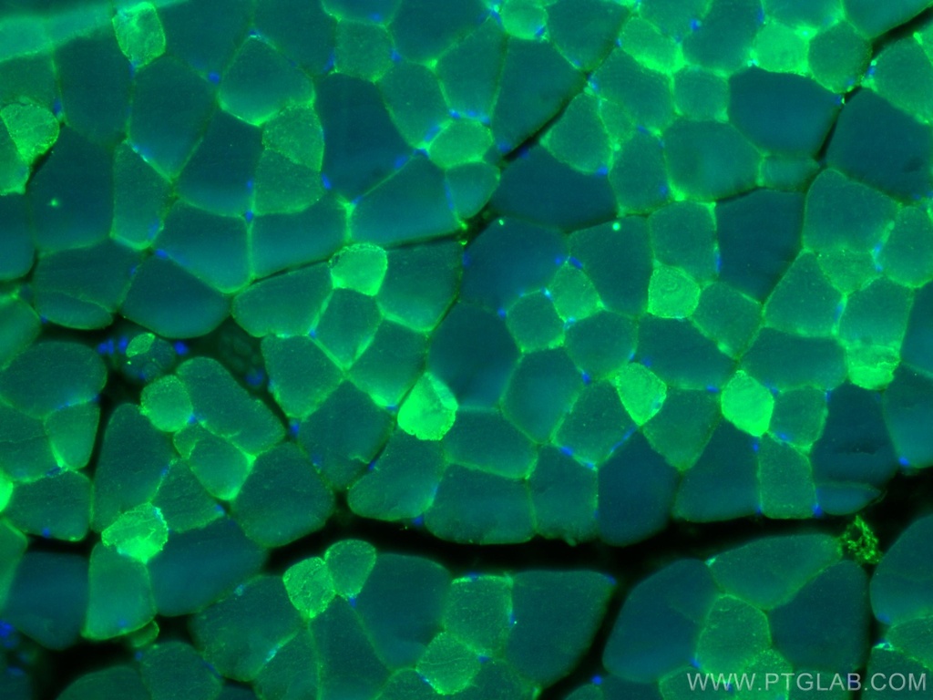 CA3 Polyclonal antibody