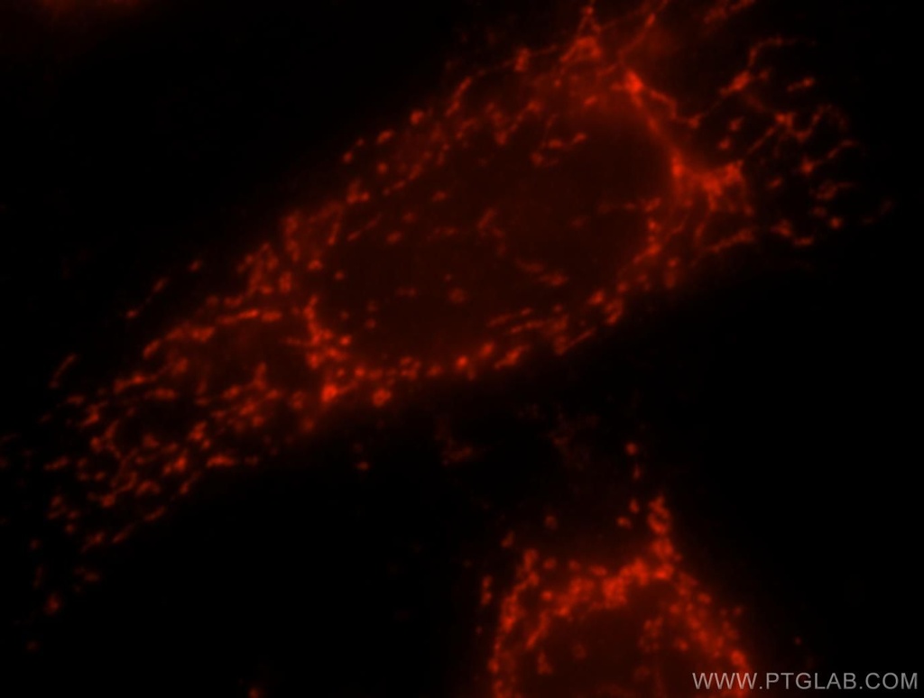 TMP21 Polyclonal antibody
