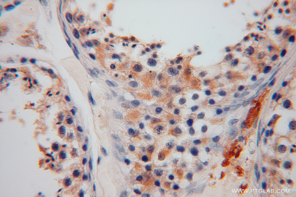 GSTM3 Polyclonal antibody