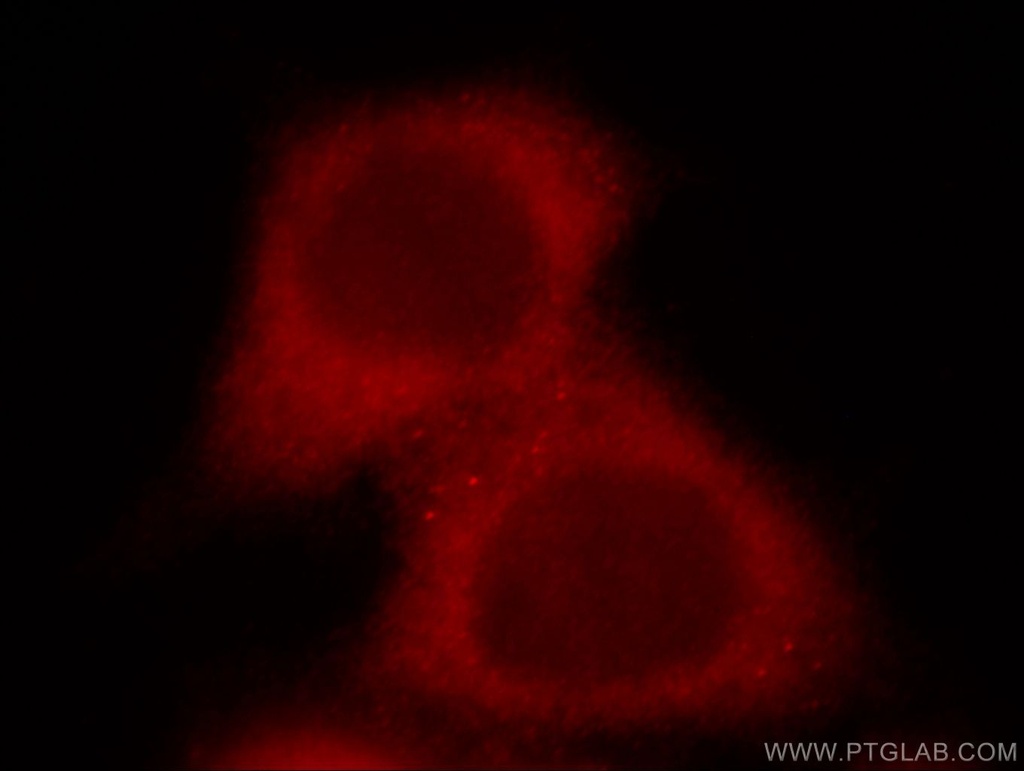 STIP1 Polyclonal antibody