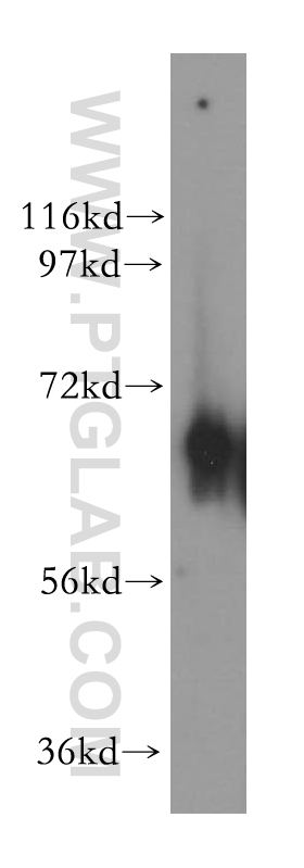 NT5C2 Polyclonal antibody