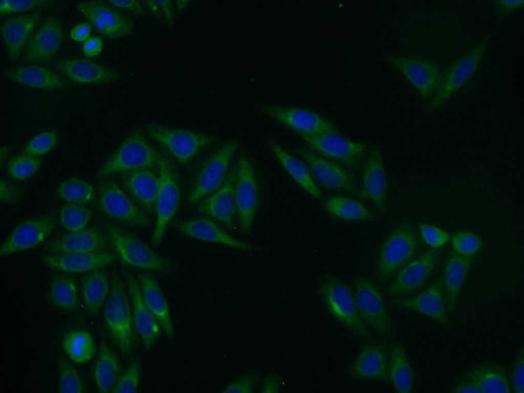 ACP2 Polyclonal antibody