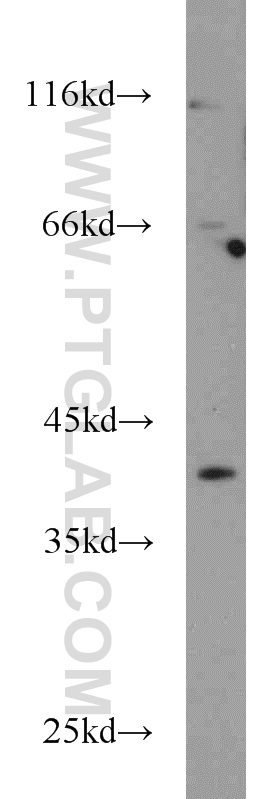 OSGIN1 Polyclonal antibody