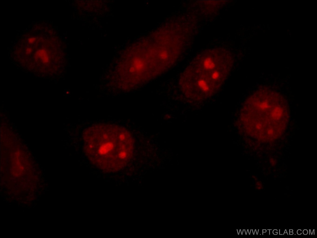 CDCA7 Polyclonal antibody