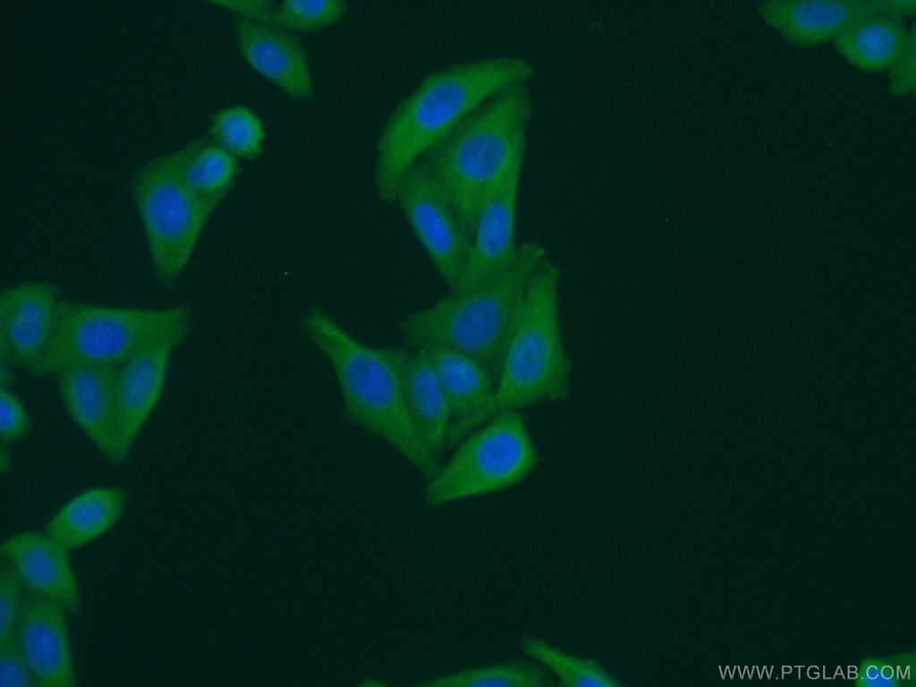 GEMIN8 Polyclonal antibody