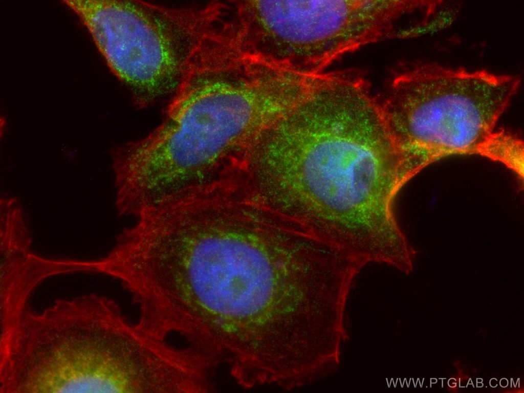 MAGED2 Polyclonal antibody