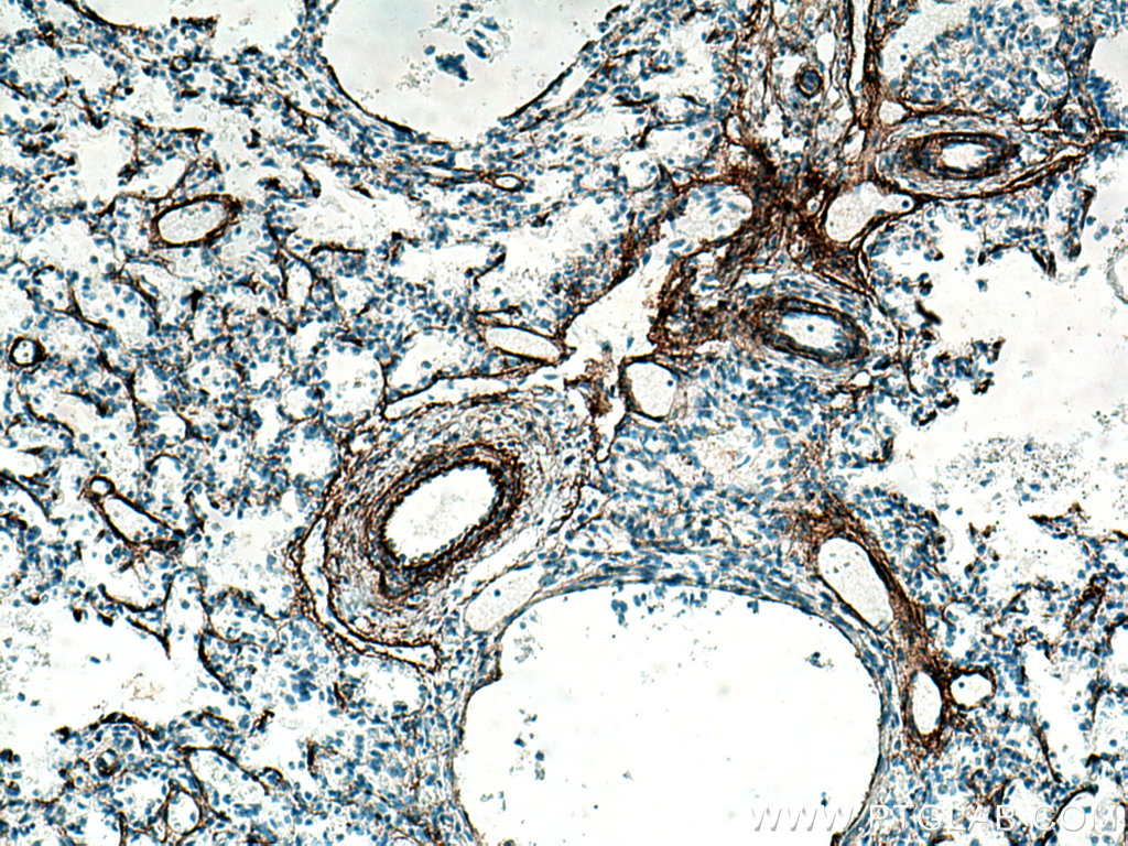 Elastin Polyclonal antibody