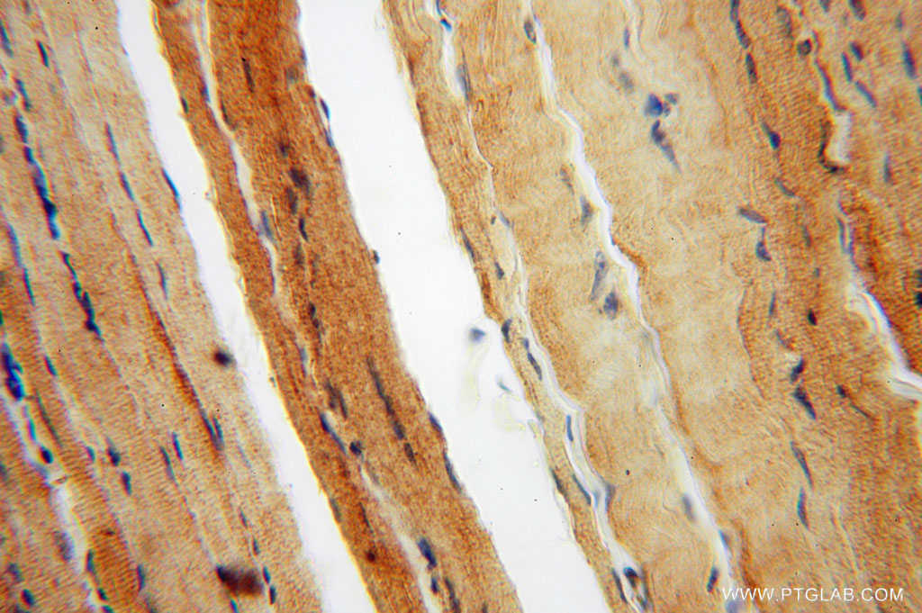 KIF1B Polyclonal antibody