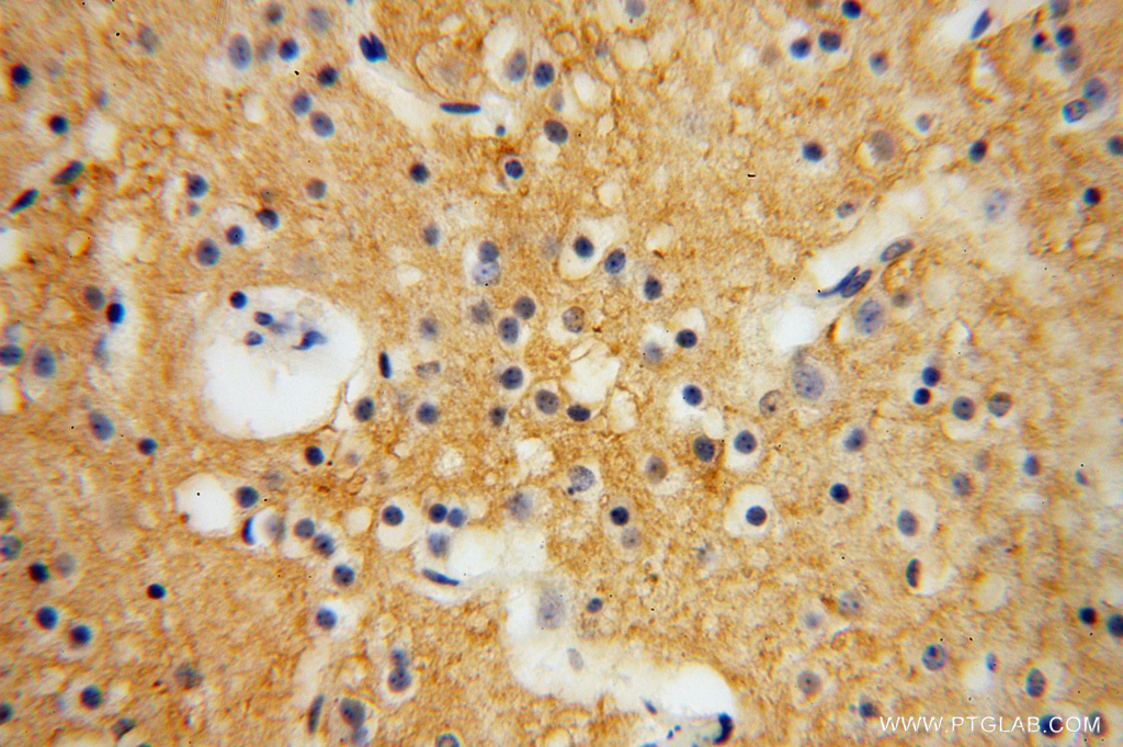 PCDHA5 Polyclonal antibody