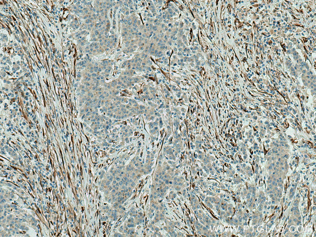 SPARC Polyclonal antibody