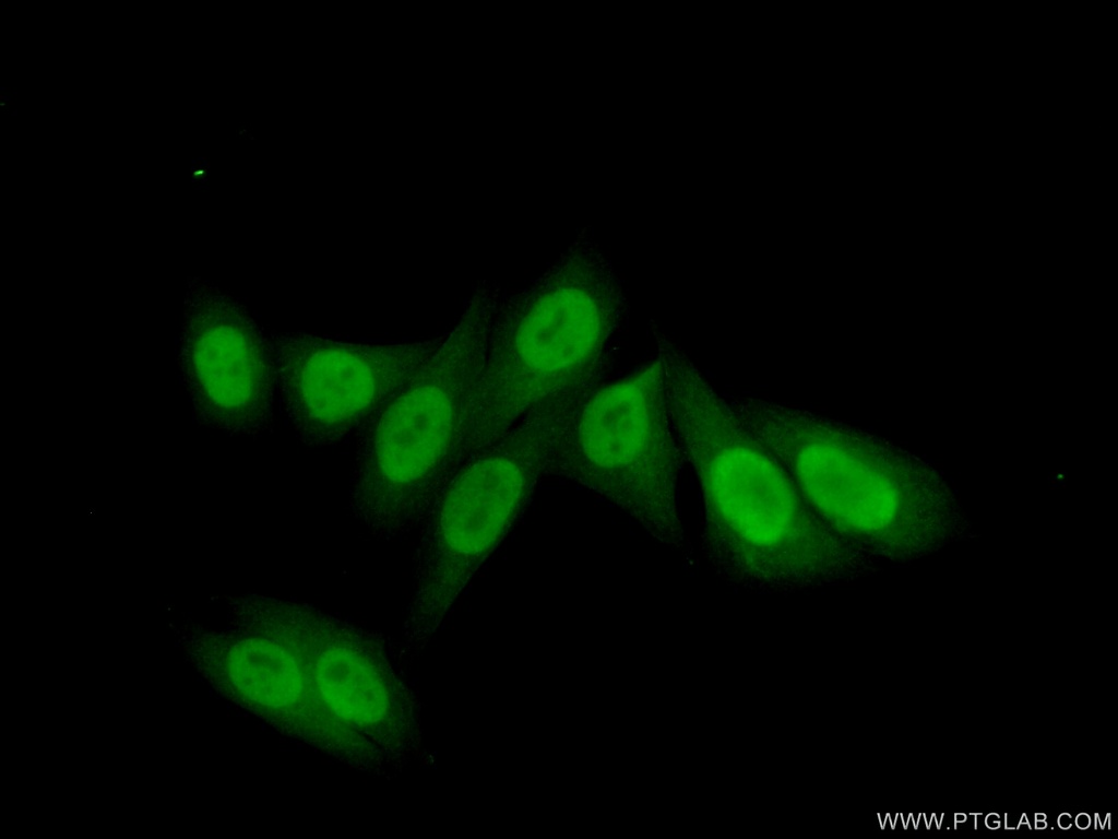 POLE3 Polyclonal antibody