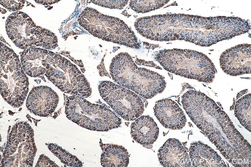 ATP6V1E1 Polyclonal antibody