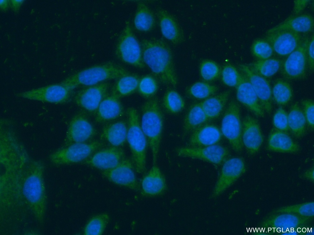 ARF5 Polyclonal antibody