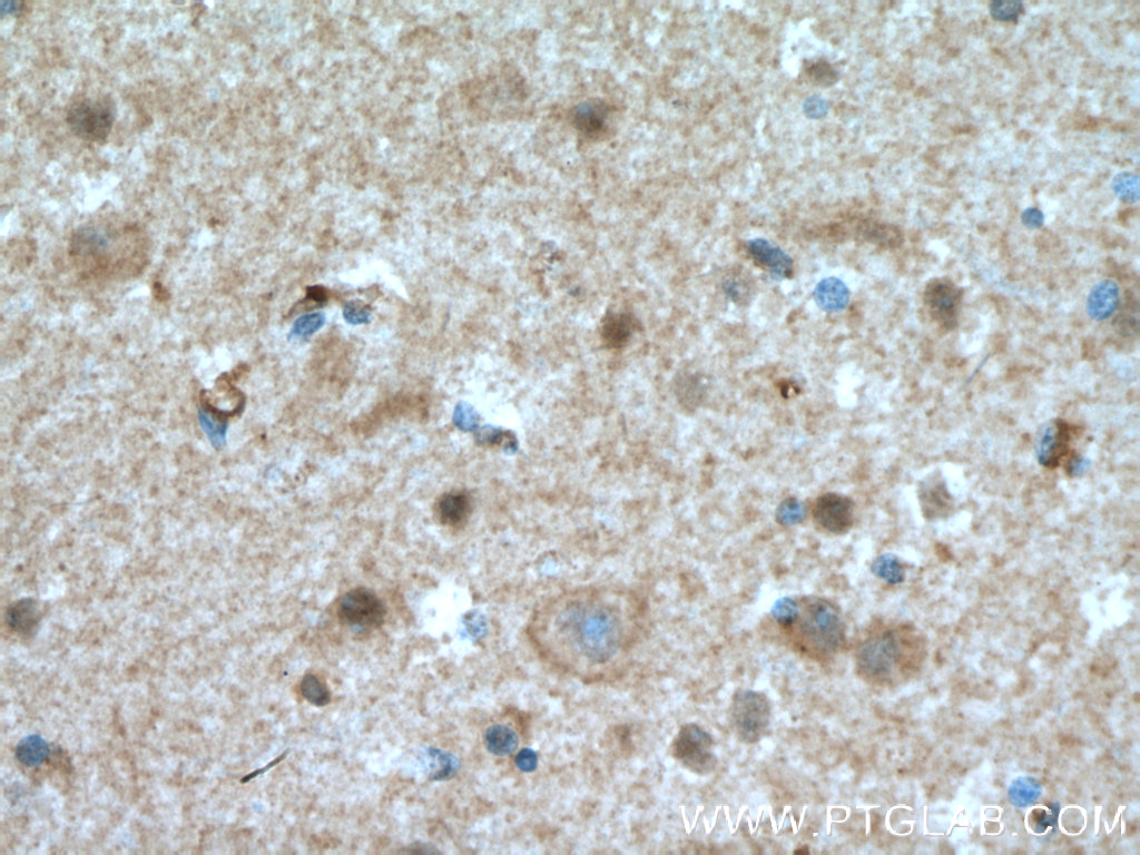 HJURP Polyclonal antibody