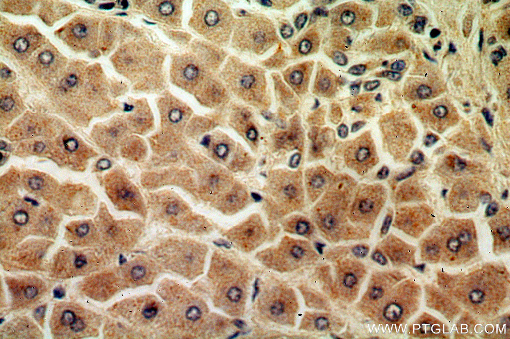 URM1 Polyclonal antibody