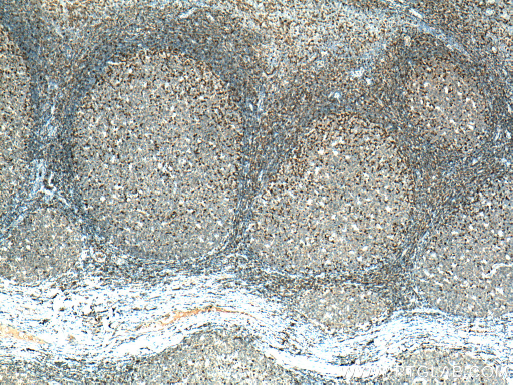 PTPN7 Polyclonal antibody