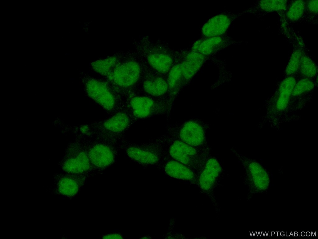 HSPB8 Polyclonal antibody