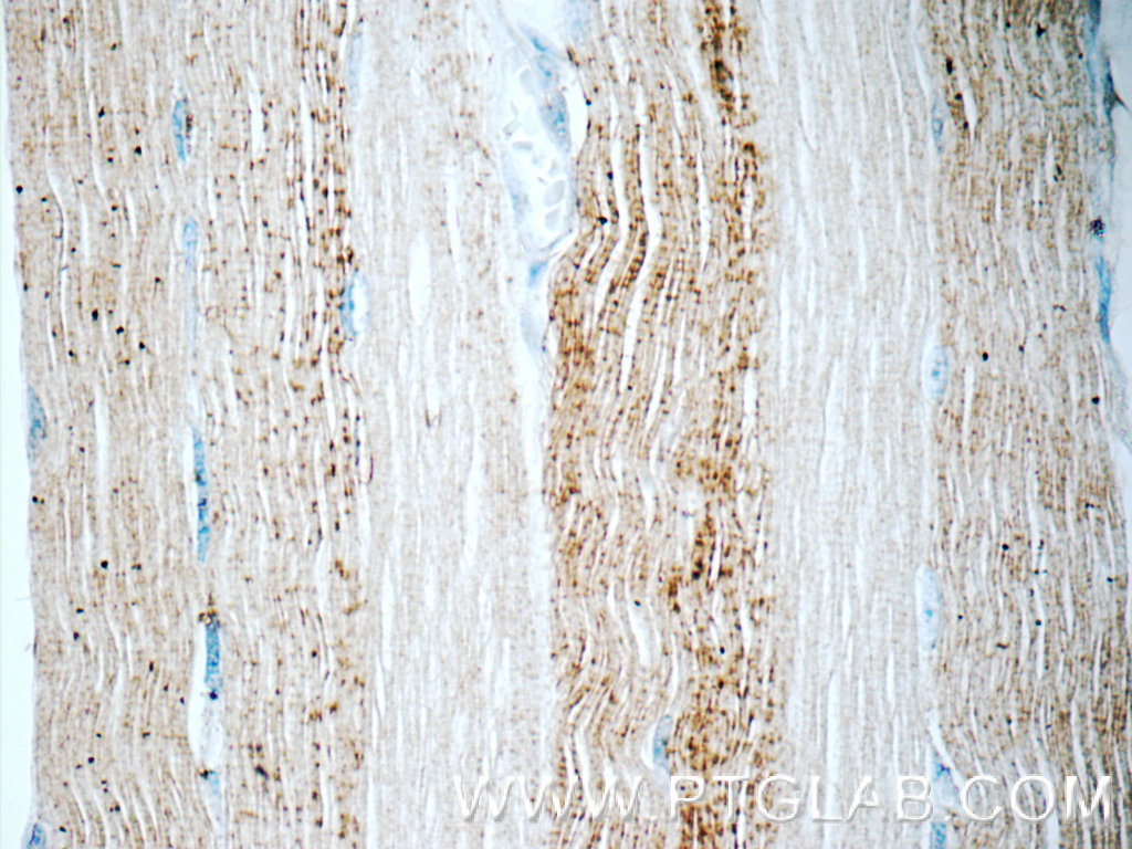 ADAMTSL4 Polyclonal antibody